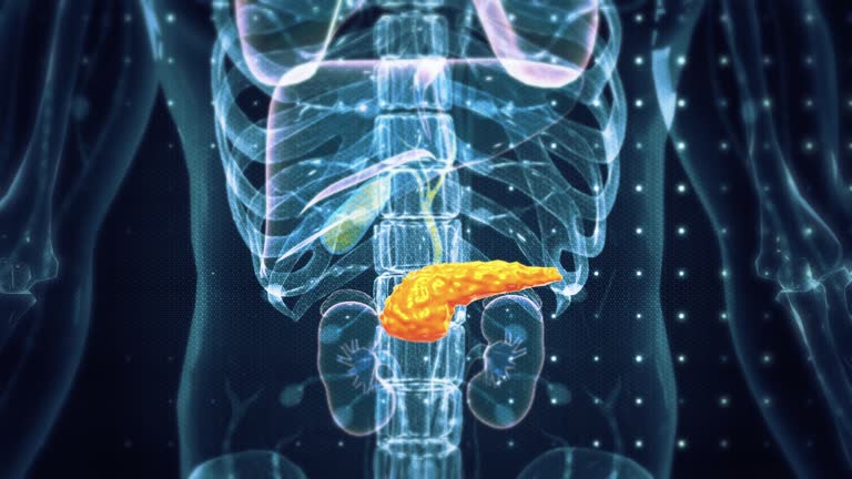 A importância de fazer a cirurgia de vesícula com rapidez